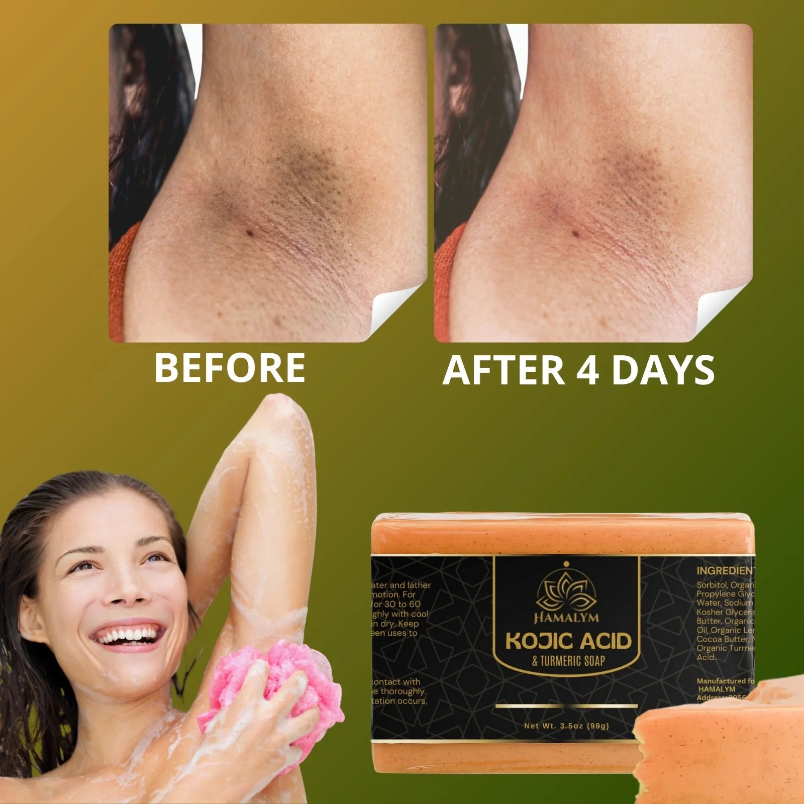 Kojic Acid & Turmeric Soap